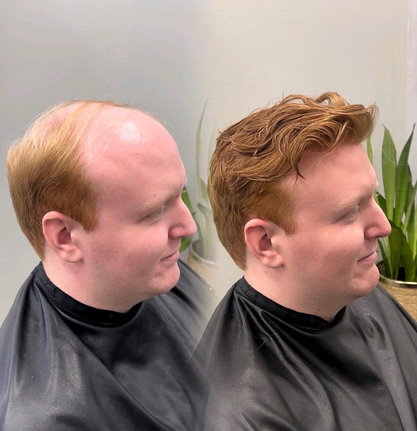 Second hair system before and after