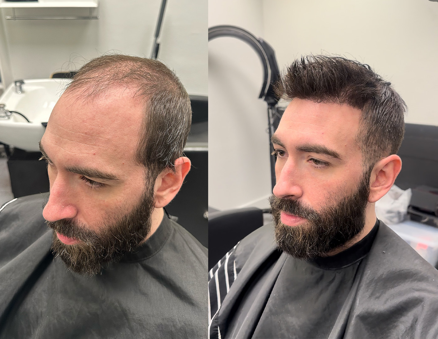 Hair system before and after